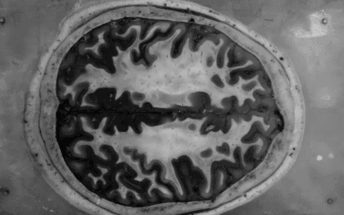 neuro-image.gif