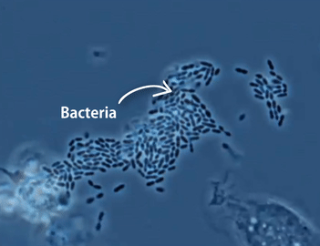 Bacteria Phagocytosis by Macrophage